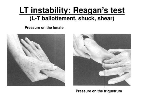 lt compression test|lt interosseous injury positive test.